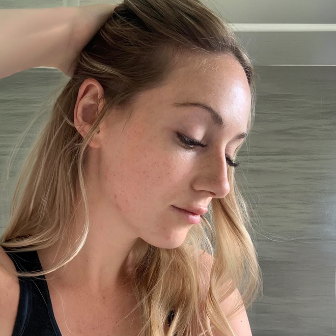 Émilie V. · 45 ans · Cure 90 jours